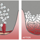 Illustration for article titled This Simple Invention Seals Gunshot Wounds in 15 Seconds Flat